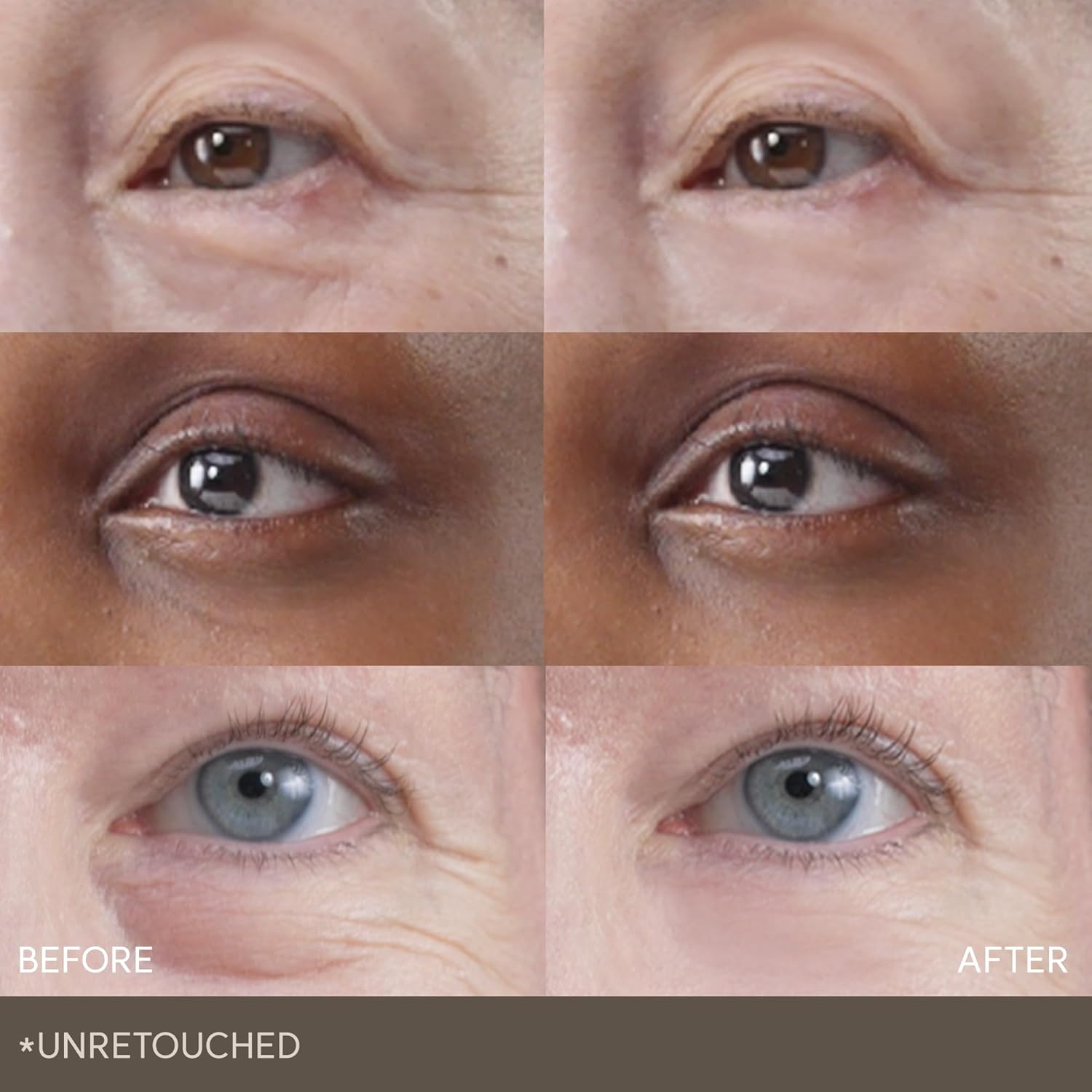 Wrinkle Repair Hydrogel Eye Patch